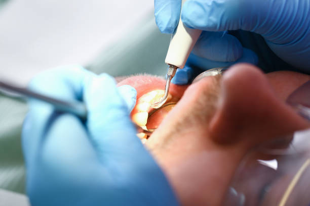 Best Emergency Dental Care for Abscessed Tooth in Rheems, PA