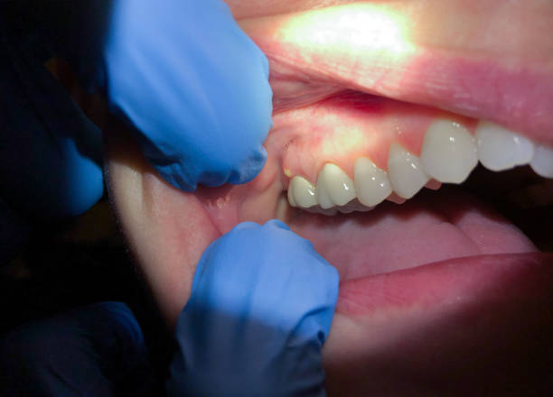Best Broken or Cracked Tooth Emergency Dentist in Rheems, PA